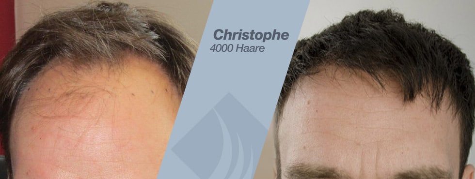 Die Masken das ebene Haar