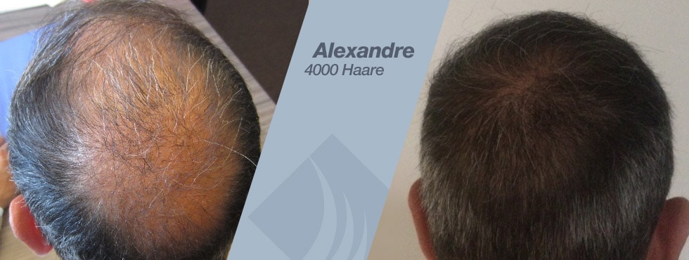Welches Öl für das Haar gut nährt