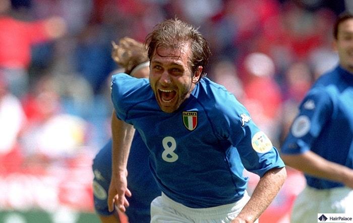 Antonio Conte Haartransplantation im 2000