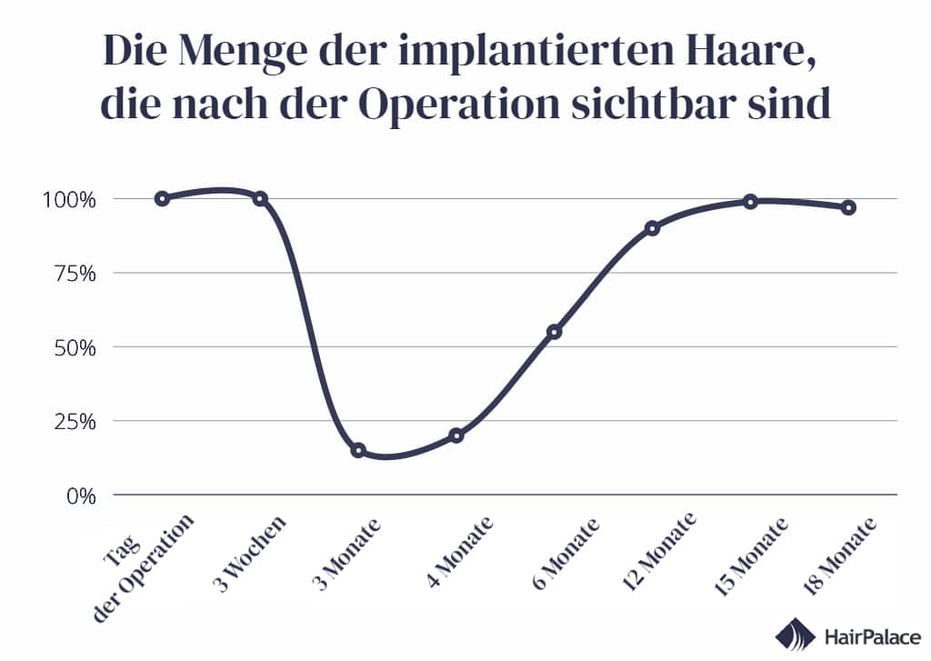 Zeitlicher Ablauf der Anzahl der implantierten Haare, die nach der Haartransplantation sichtbar sind