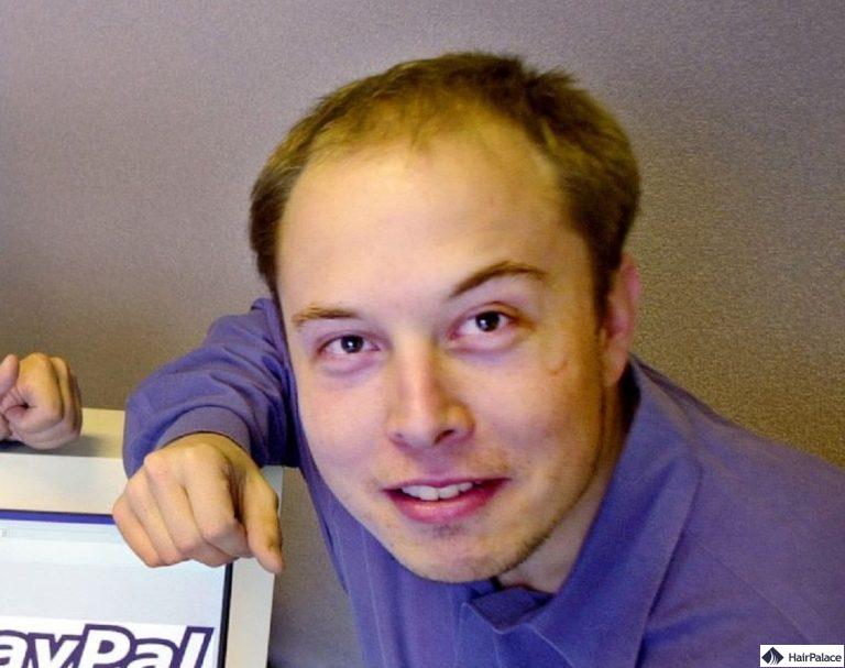 elon musk Kahlheit