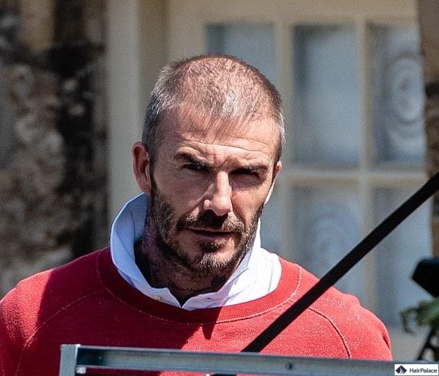 david-beckham-moegliche-haartransplantation-im-jahr-2020