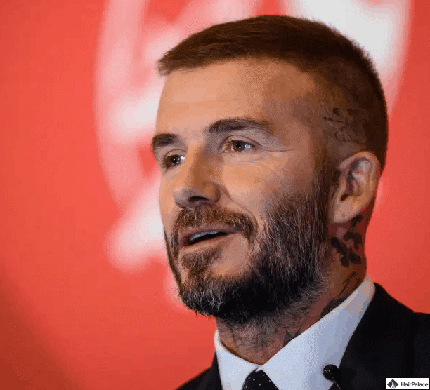 david-beckham-nach-der-haartransplantation