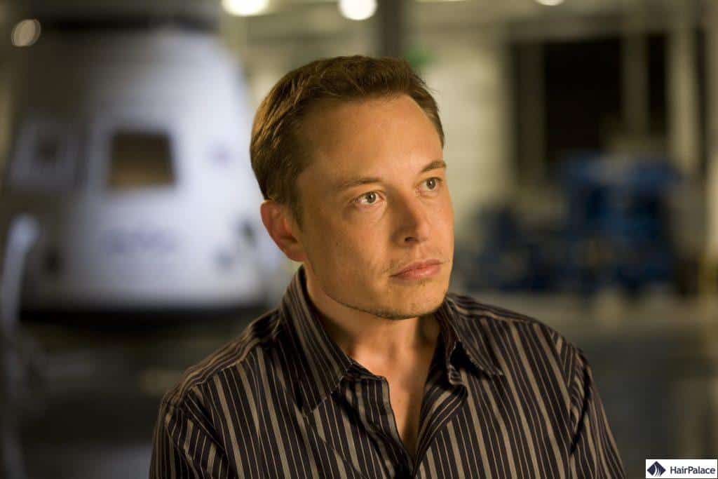 Elon Musk hatte eine erfolgreiche Haartransplantation