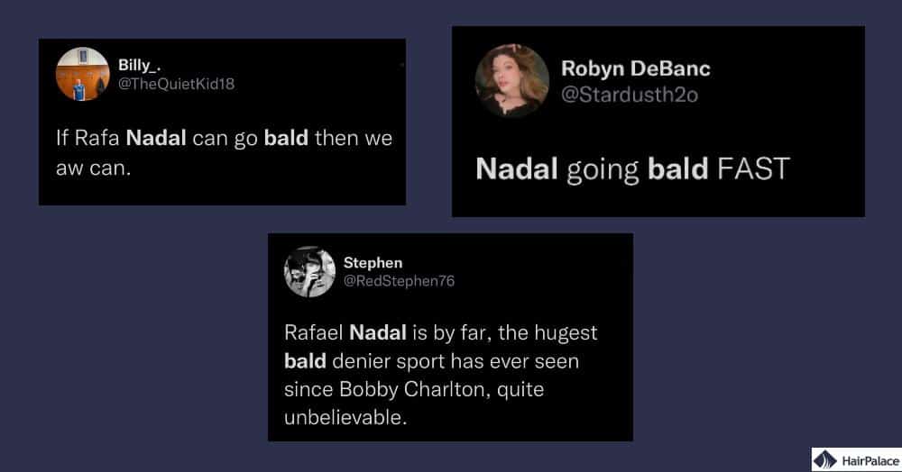 Reaktionen der Fans auf Nadals kürzlichen Haarausfall
