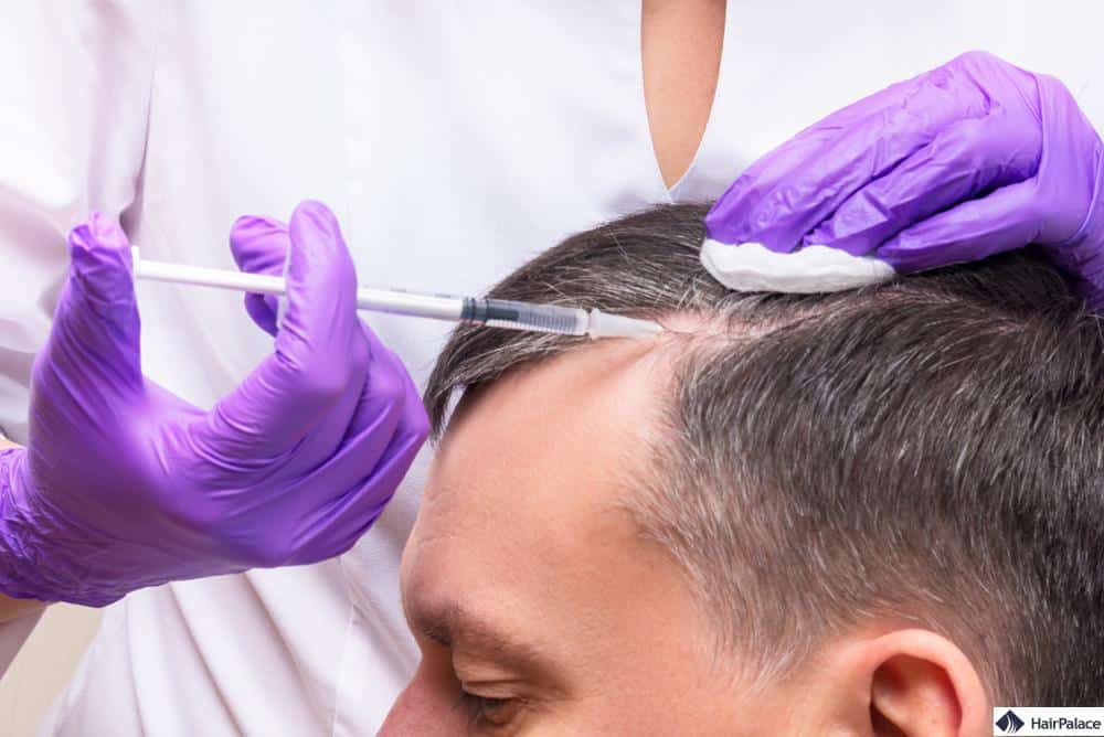 PRP-Behandlungen gegen Haarausfall