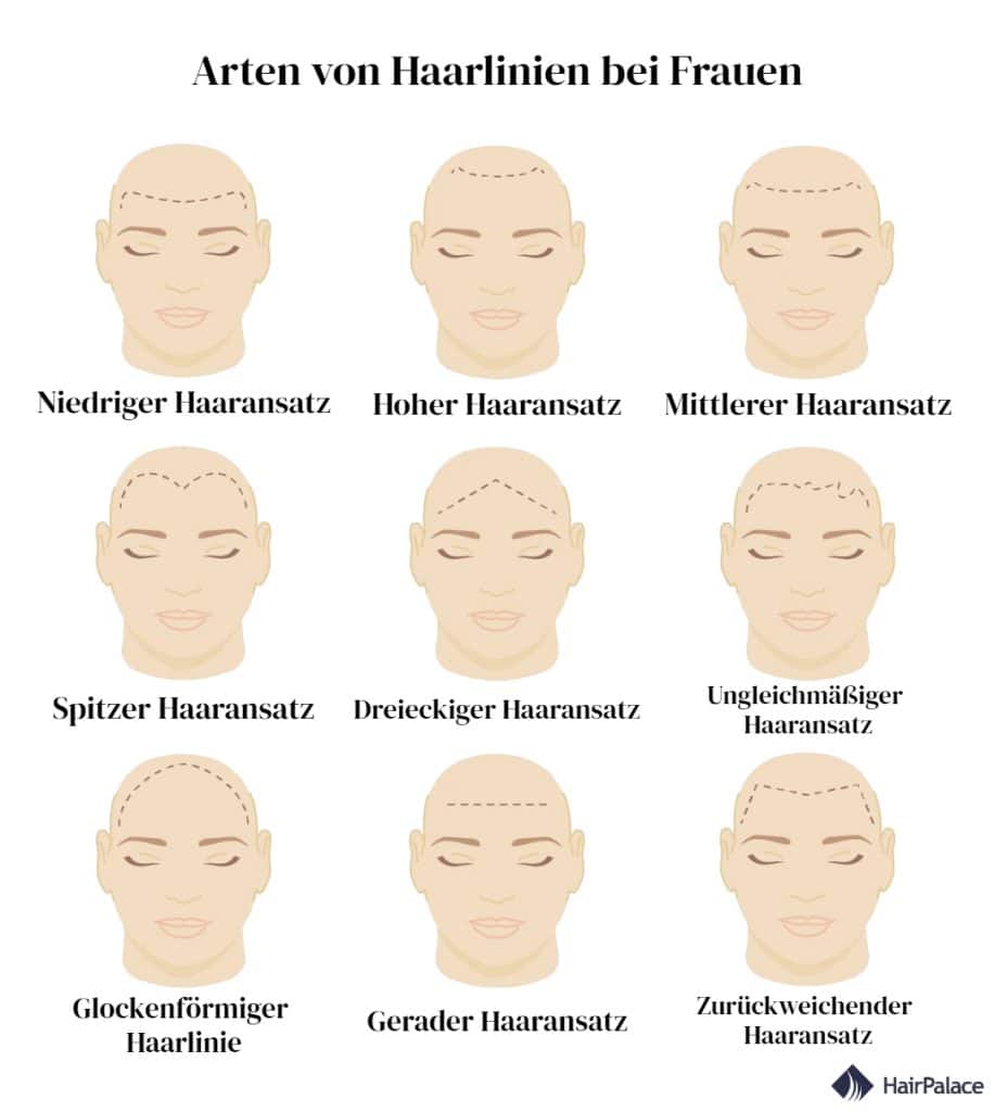 9 Arten von Haarlinien bei Frauen