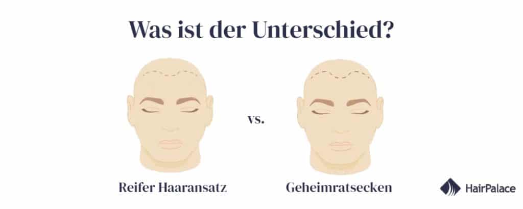 Reifende Haarlinie vs. zurückweichende Haarlinie