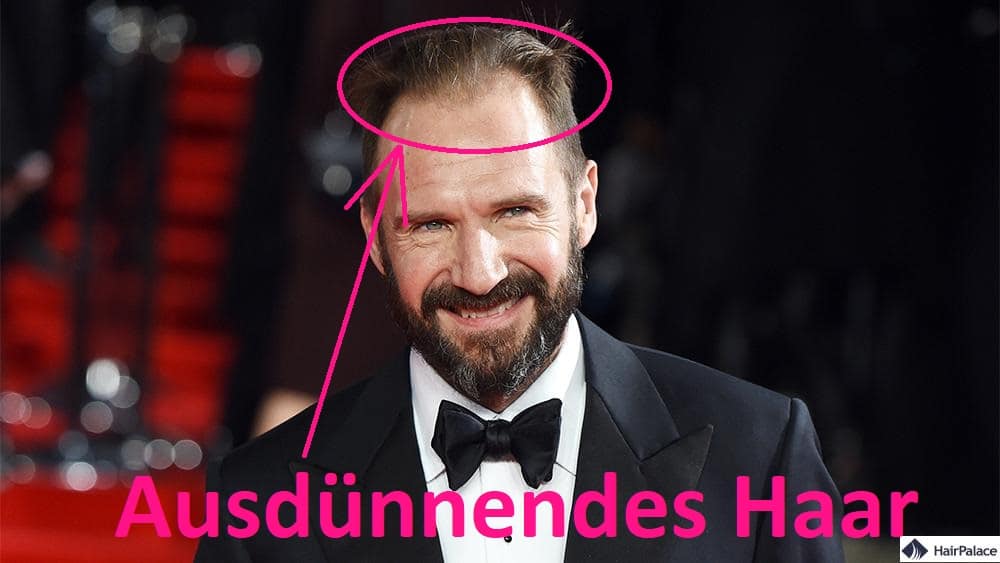 Ralph Fiennes mit schütterem Haar