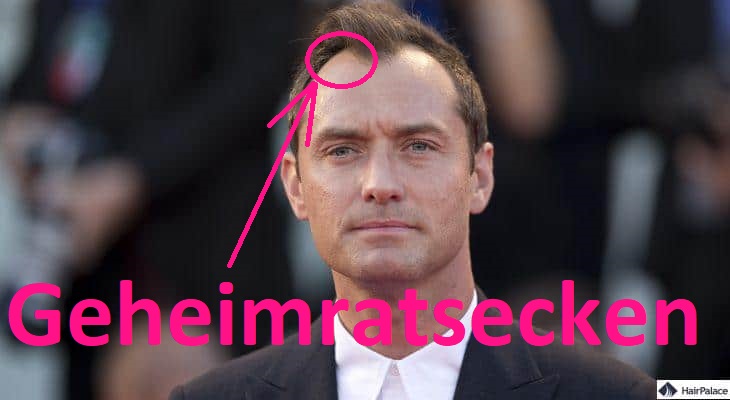 Jude Law geheimratsecken