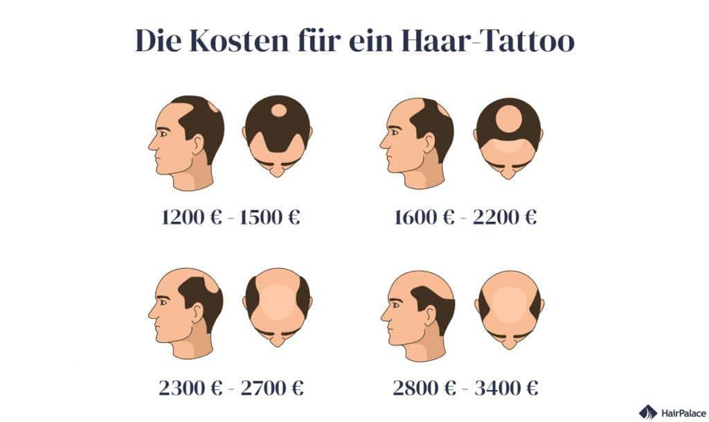 Die Kosten für ein Haar-Tattoo