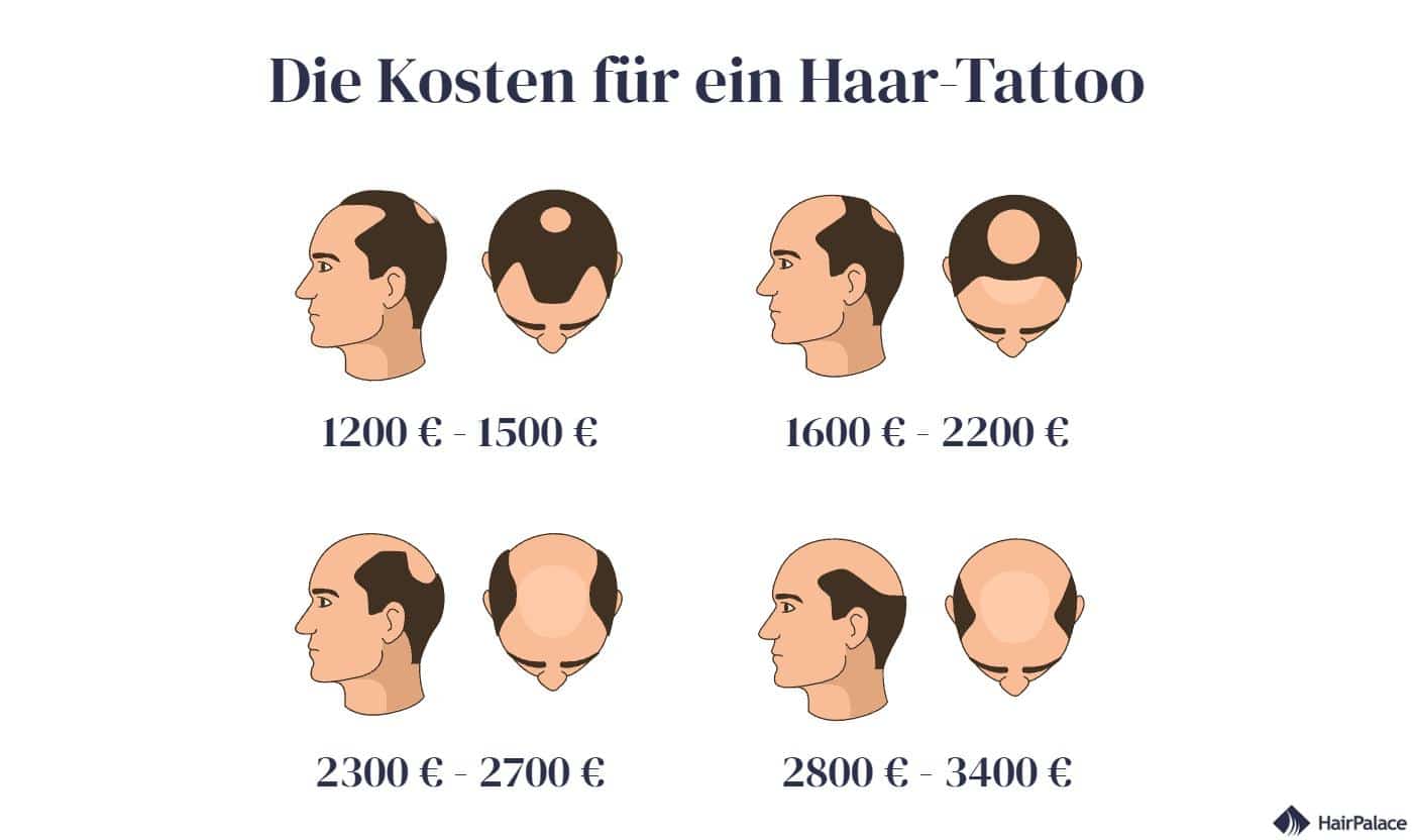 HaarTattoo Kosten, Ergebnisse, Nutzen und Risiken