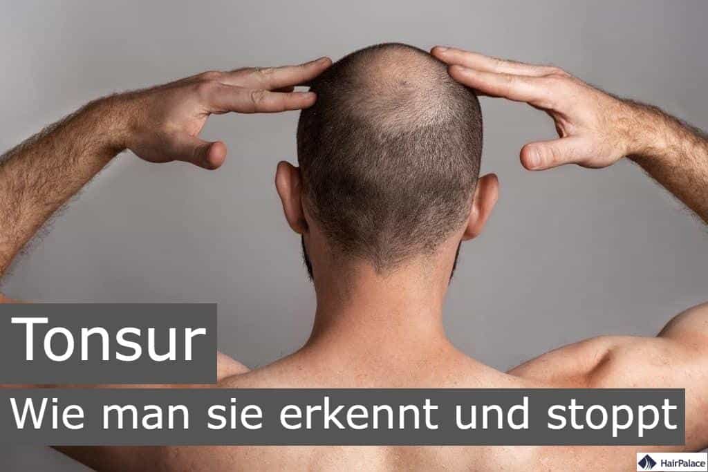 tonsur wie man sie erkennt und stoppt