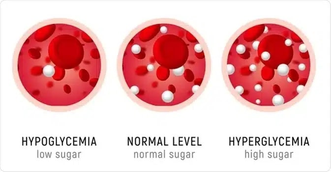 Diabetes beeinflusst den Blutzuckerspiegel