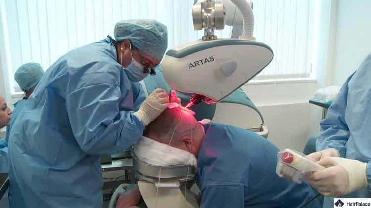 Bei der Roboter-Haartransplantation wird ein Roboter für die Extraktion verwendet