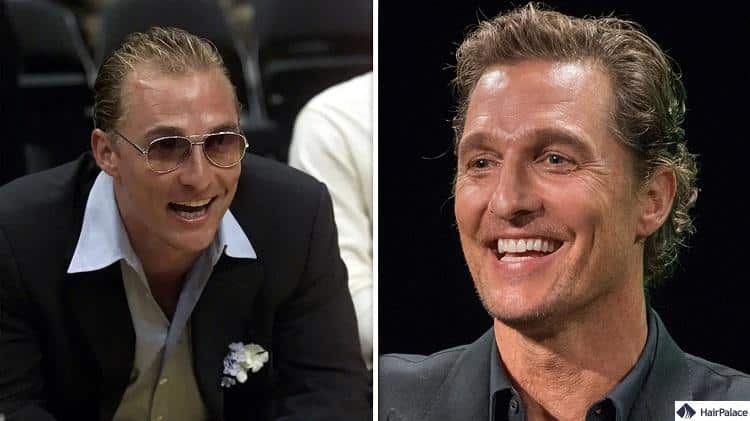 Matthew McConaughey Haartransplantation vorher und nachher