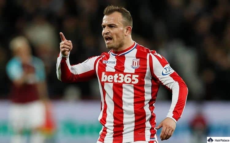 Shaqiri haarausfall Stoke