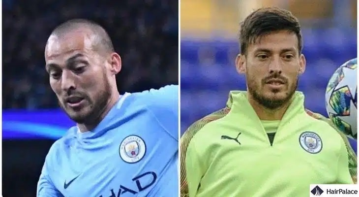 David Silva Haartransplantation vorher und nachher