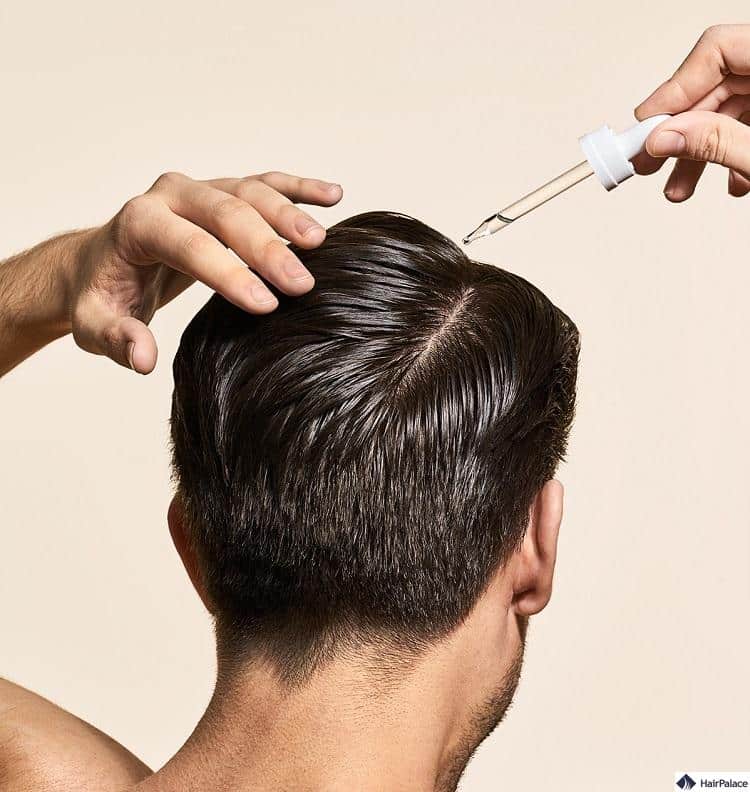 topisches Finasterid ist ein neue Methode zur Behandlung von Haarausfall