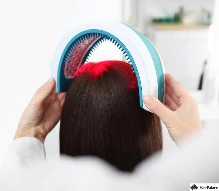 Lasertherapie kann das Haarwachstum stimulieren