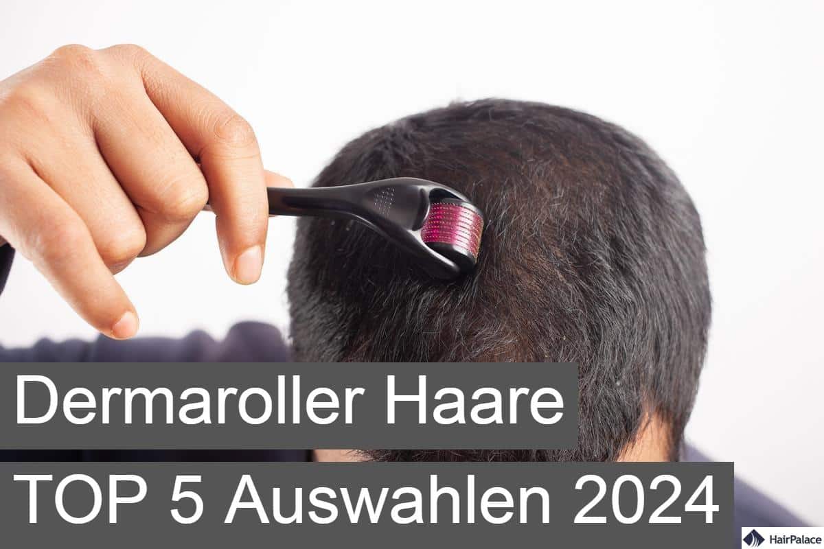 dermaroller haare top 5 auswahlen 2024