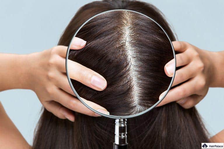 Wie Viele Haare Hat Man Auf Dem Kopf www.hairpalace.de