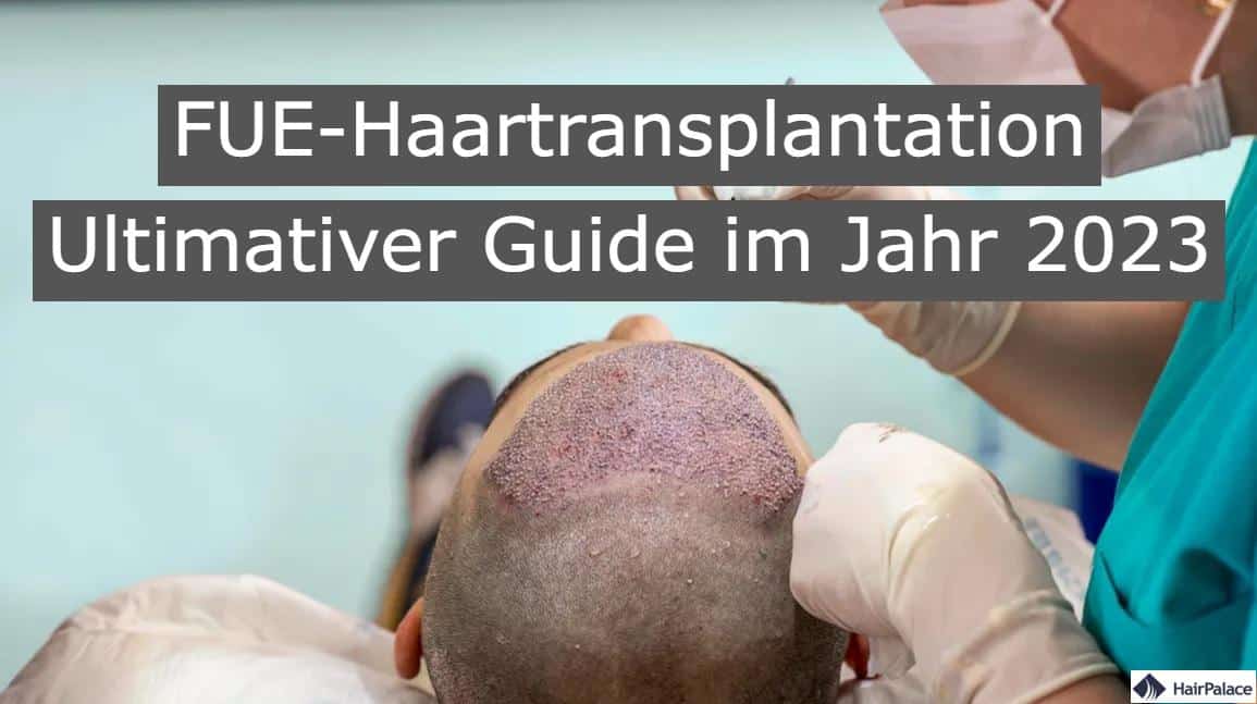 FUE haartransplantation ultimativer guide im jahr 2023