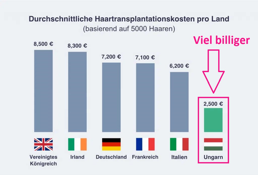 haartransplantation kosten pro land