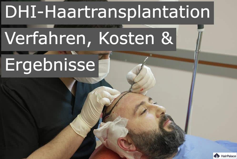 dhi haartransplantation verfahren, kosten und ergebnisse