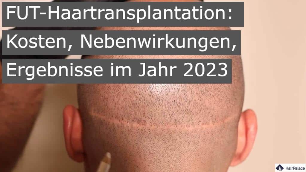 FUT haartransplantation Kosten Nebenwirkungen ergebnisse im jahr 2023