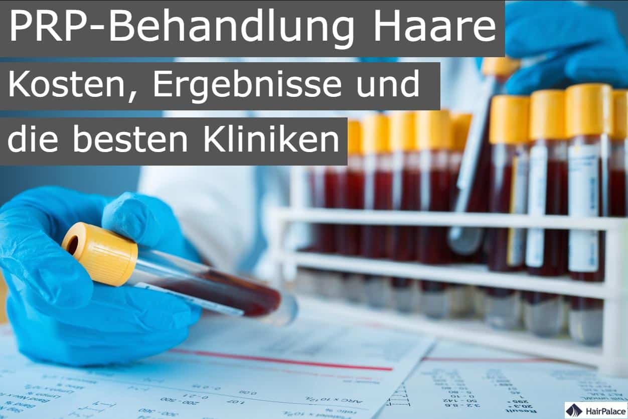 PRP behandlung haare kosten ergebnisse und die besten kliniken