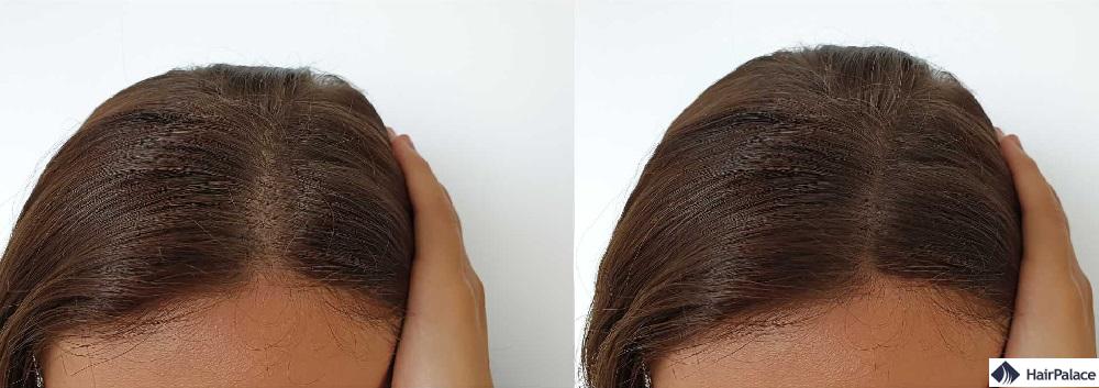 Biotin für das Haarwachstum