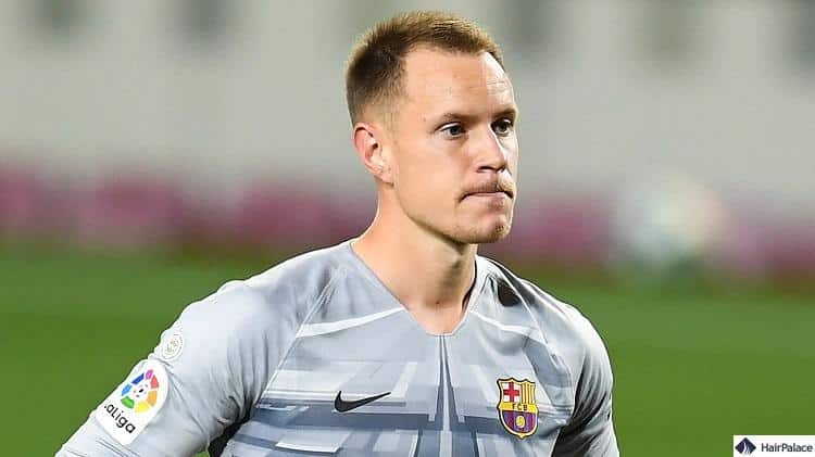 ter stegen Haare vor Haartransplantation