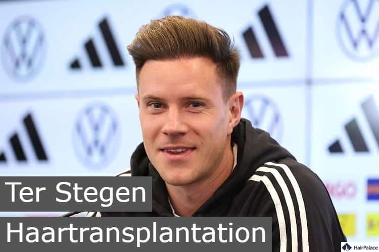 ter stegen haartransplantation